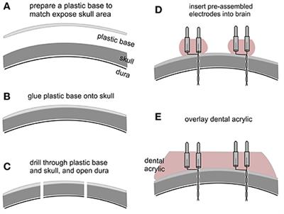 Continuous Monitoring via Tethered Electroencephalography of Spontaneous Recurrent Seizures in Mice